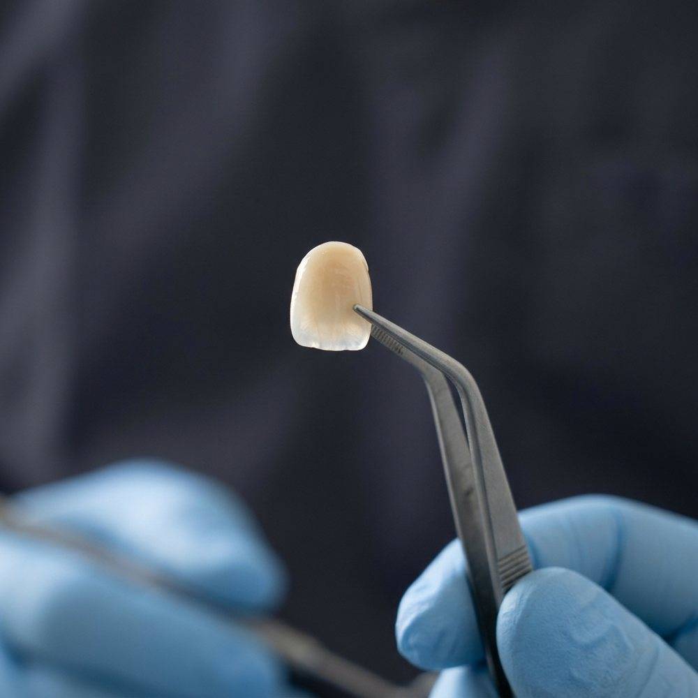 An anterior ceramic crown held up to daylight, its incisal edge transmitting light to show lithium disilicate translucency