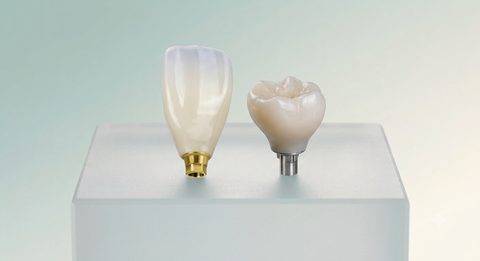Implants